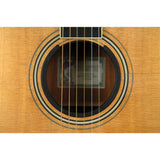 O-PORT Acoustic Sound Enhancer